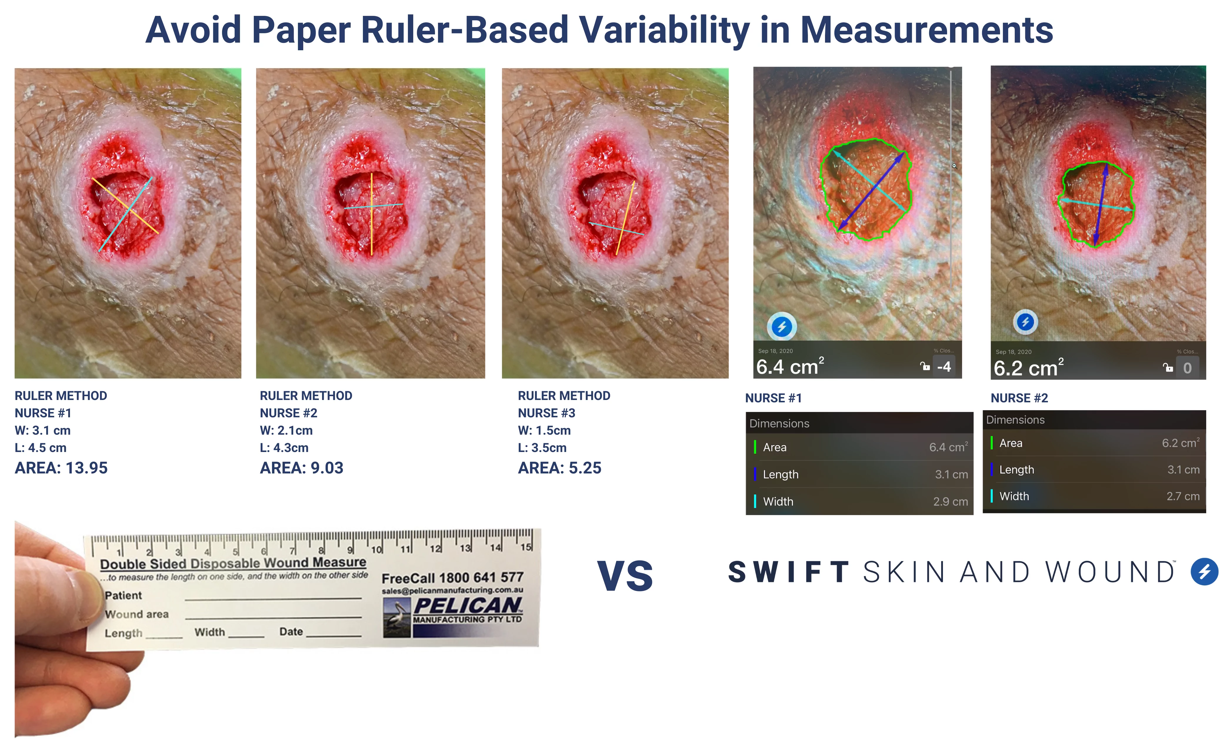 Avoid Paper Ruler-based variability.png